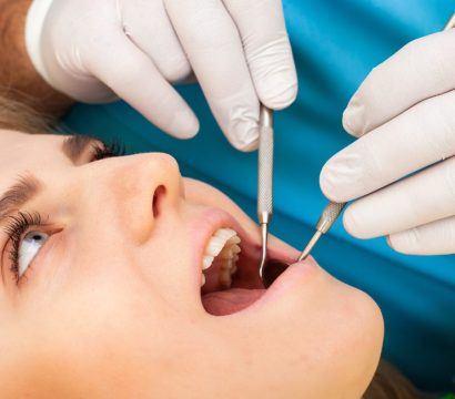 Caucasian blonde woman getting her teeth checked.