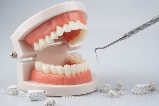 Model of human teeth and a plaque removal tool. 