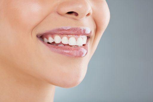 Woman’s smile showing white teeth and pink gums.